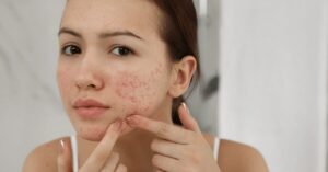 Hormonal Imbalance Symptoms