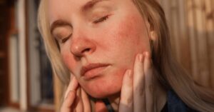What Your Skin, Joints, and Brain Have in Common When They All Flare at the Same Time
