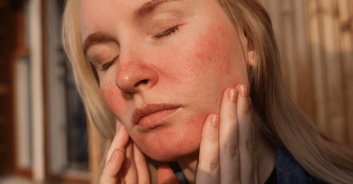 What Your Skin, Joints, and Brain Have in Common When They All Flare at the Same Time